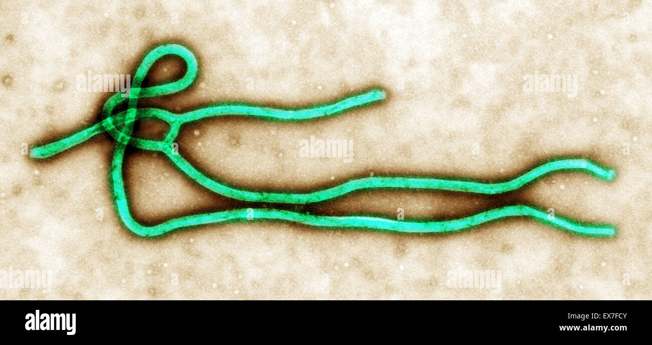 Transmission electron micrograph (TEM) of an Ebola virus virion. Stock Photo