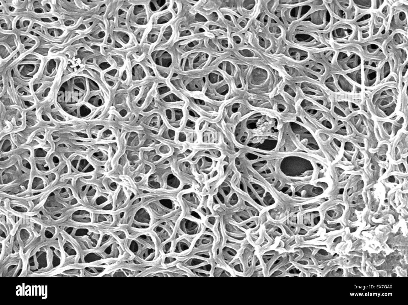 Scanning electron micrograph of Borrelia burgdorferi spirochete bacteria Stock Photo