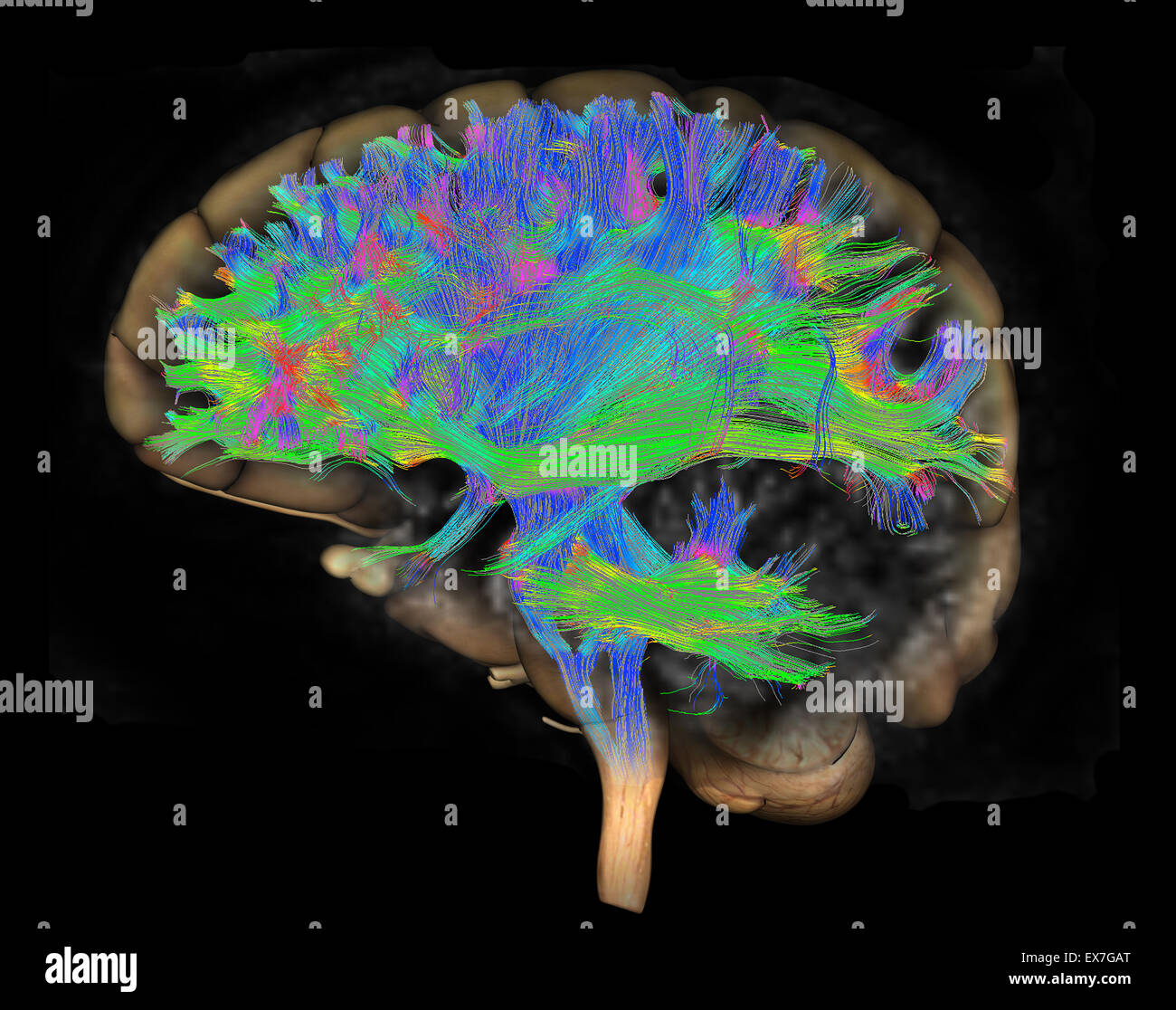 Fiber tractography image of the human brain Stock Photo