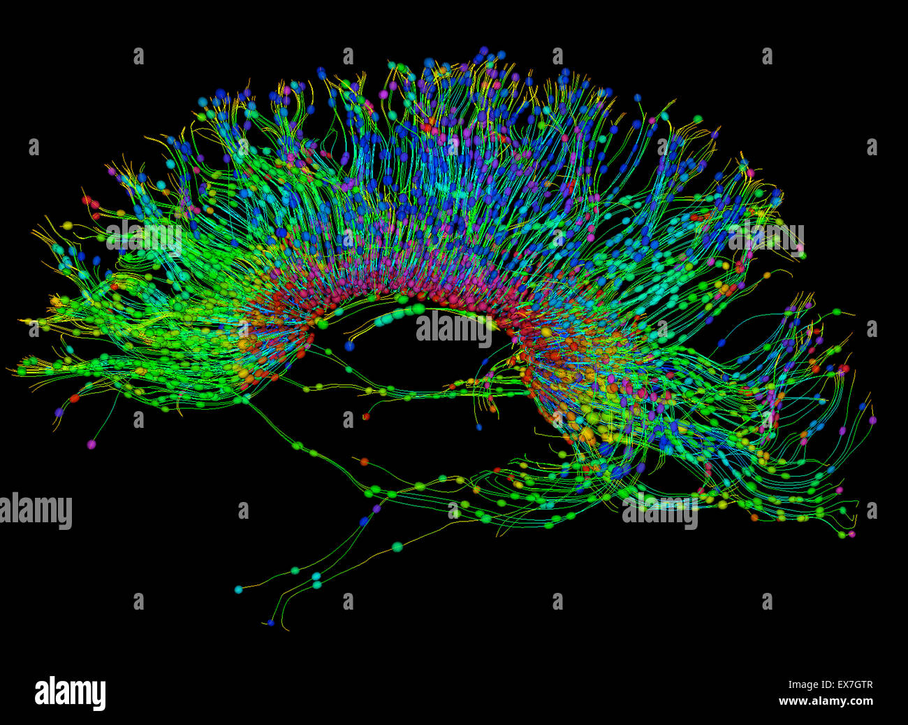 Fiber tractography image of the human brain Stock Photo