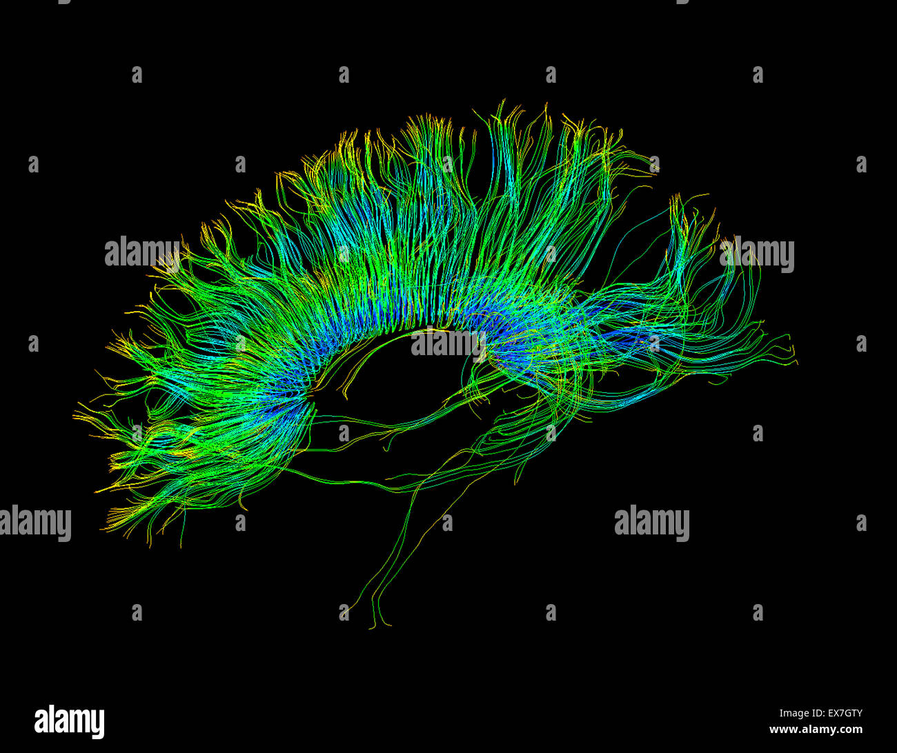 Fiber tractography image of the human brain Stock Photo