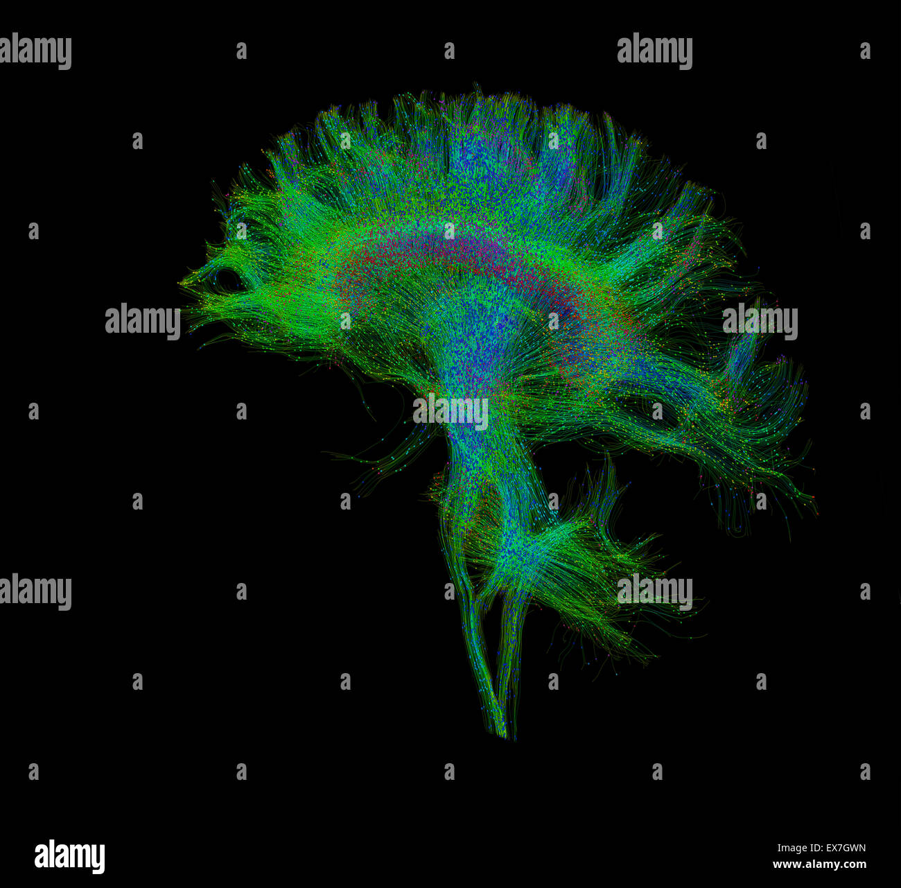 Fiber tractography image of the human brain Stock Photo