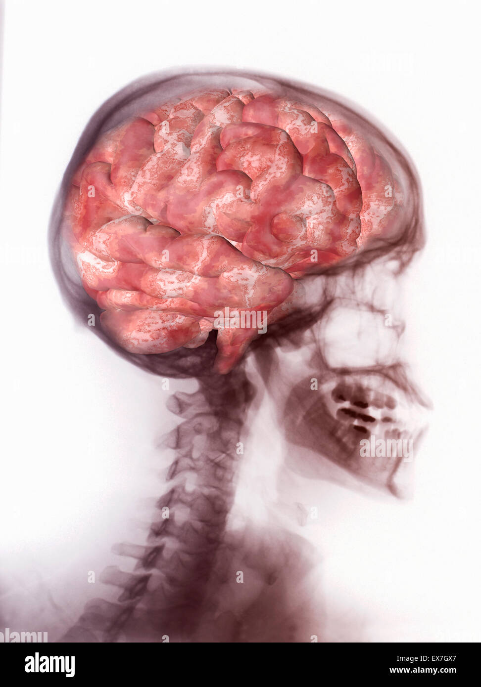 illustration of the human brain superimposed on the head and skull Stock Photo