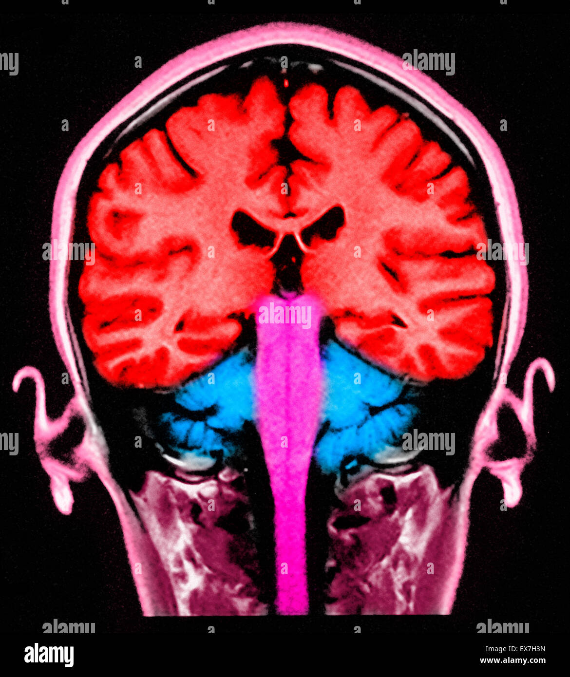 MRI brain scan, sagittal view Stock Photo