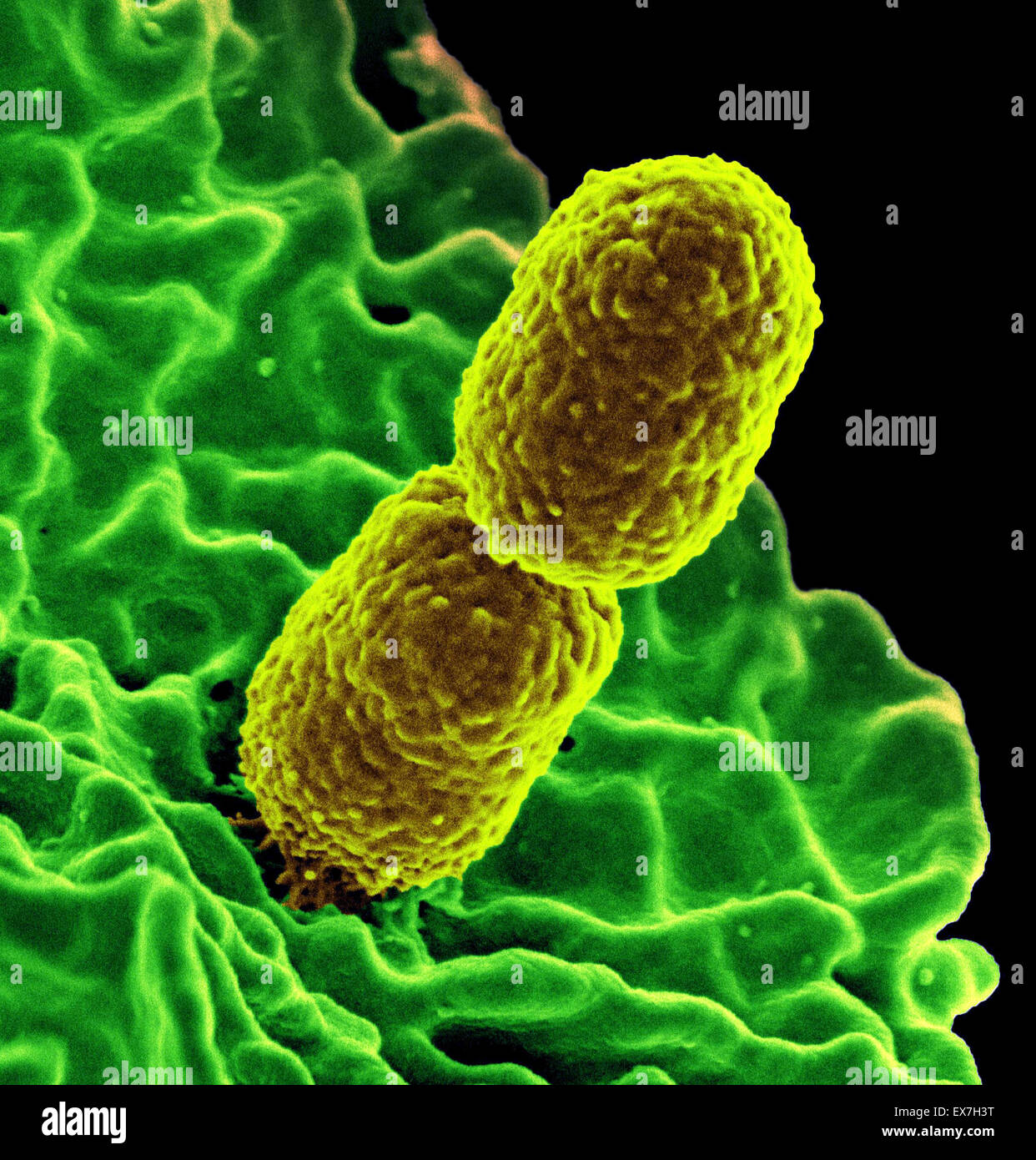 Colorized scanning electron micrograph of rod-shaped carbapenem-resistant Klebsiella pneumoniae (CRKP) bacteria. Stock Photo