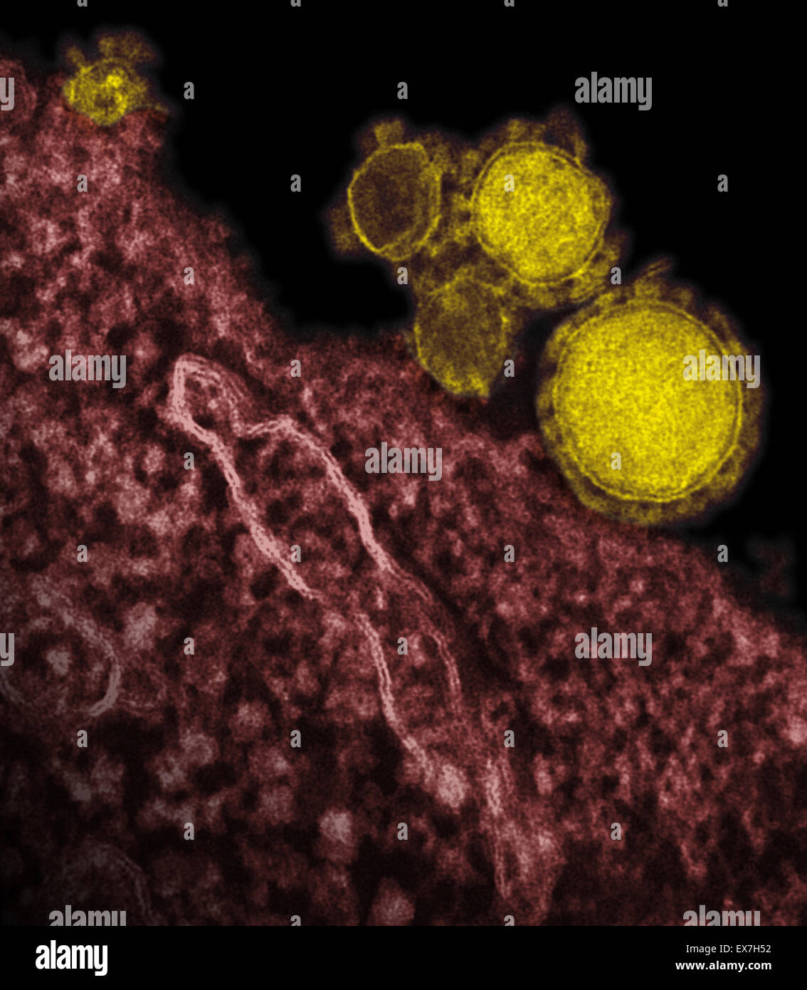 Colorized transmission electron micrograph of Middle East Respiratory Syndrome Coronavirus (MERS-CoV) virions Stock Photo