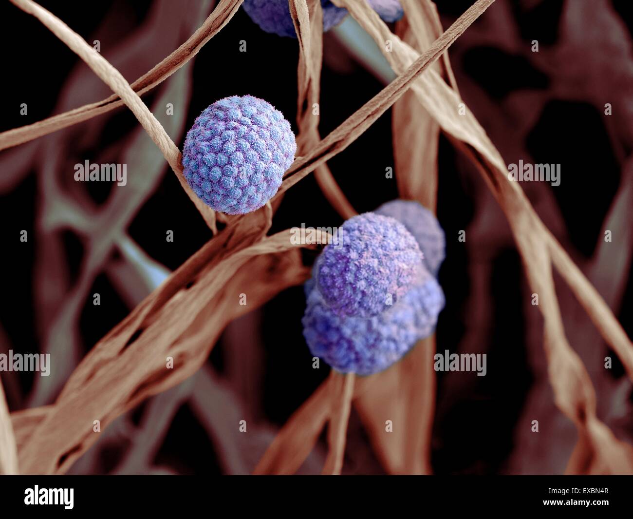 Coloured scanning electron micrograph (SEM) of fungal cells. The round structures are sporangia, which house the fungus' Stock Photo