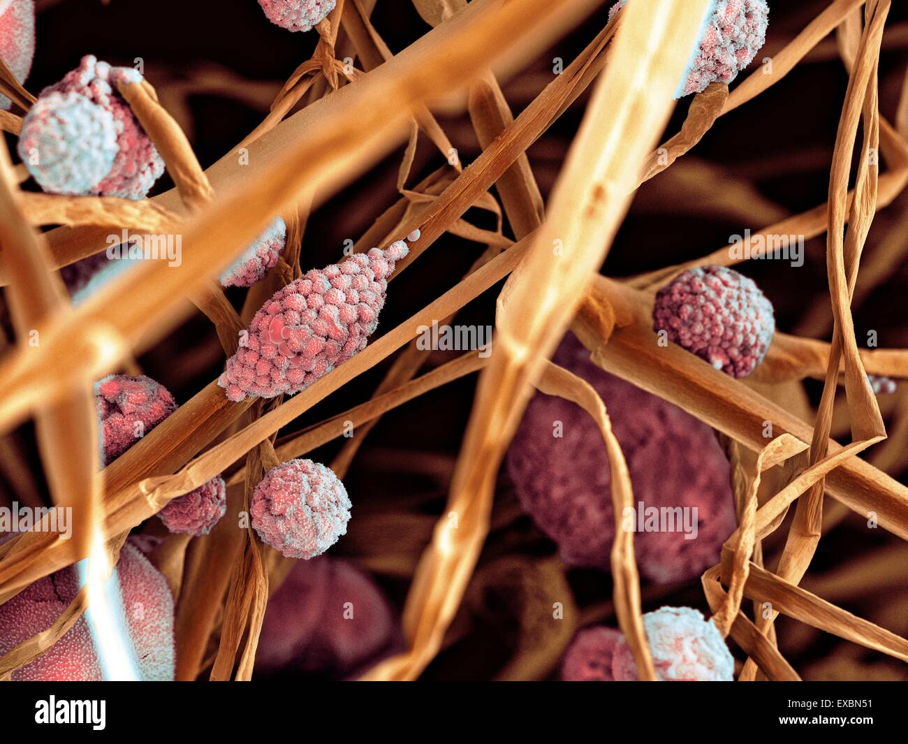 Coloured scanning electron micrograph (SEM) of fungal cells. The round structures are sporangia, which house the fungus' Stock Photo