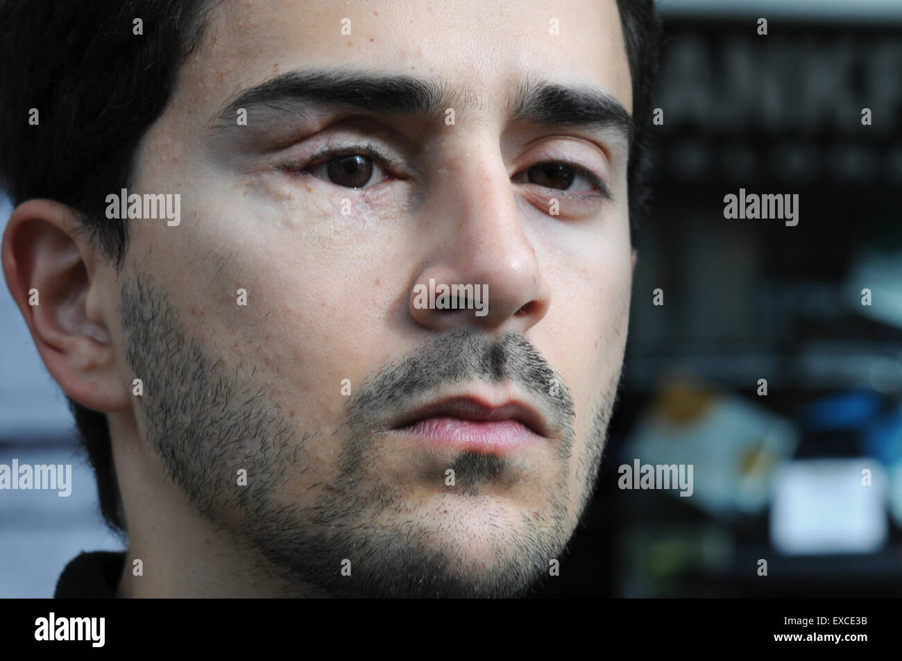 Nicola Tanno, Italian, one of those affected by the use of rubber bullets at the place where he was shot, the Frankfurt Mas located next to Plaza Spain in Barcelona. Spain. He lost an eye. Police violence. Dangerous weapons. Stock Photo