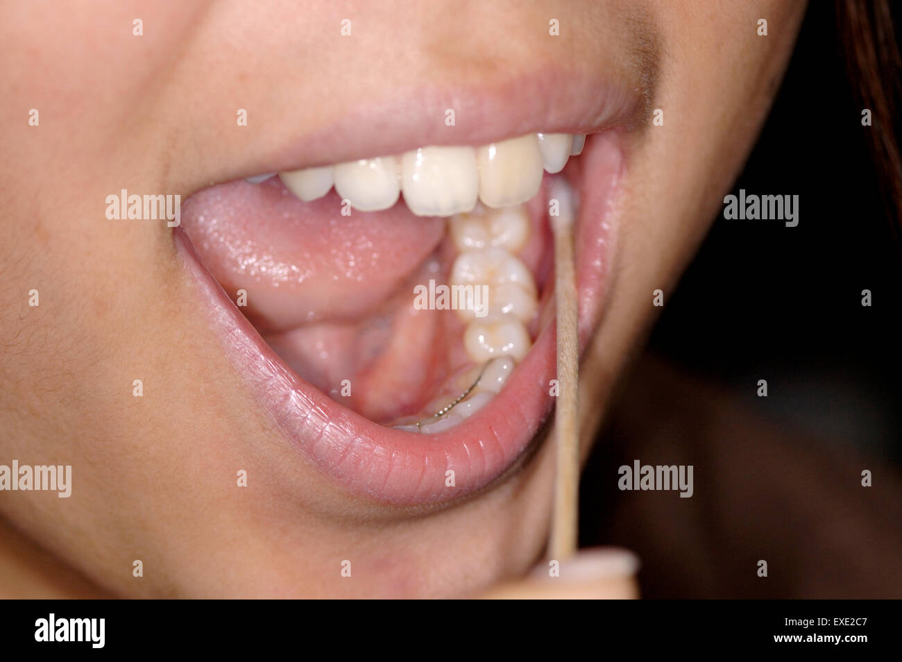 Asian person student swabbing her cheek to obtain cells for DNA fingerprinting study Stock Photo