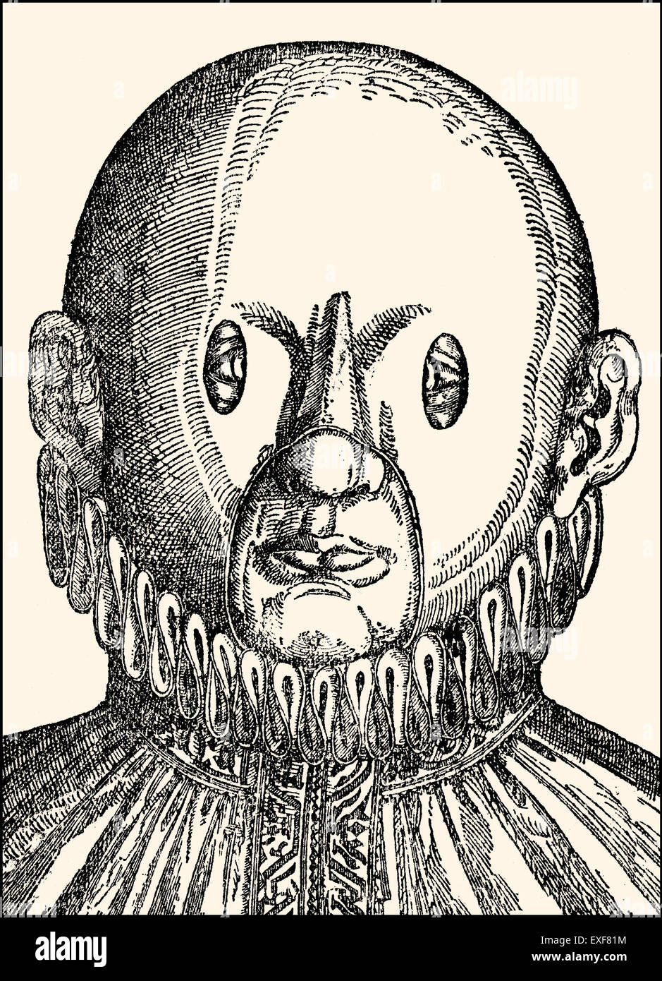 Treatment of the Eye, strabismus, crossed eyes, Georg Bartisch, Ophthalmodouleia, 1583, Stock Photo