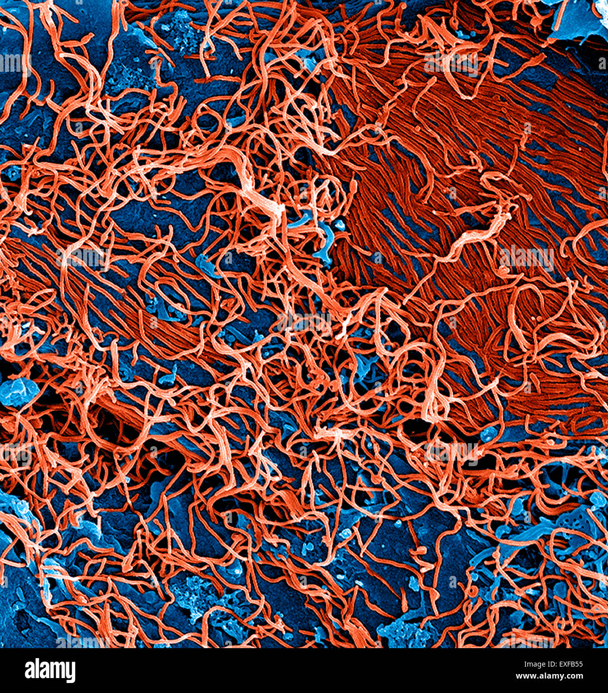 Filamentous Ebola virus particles (colored red) budding from a chronically-infected VERO E6 cell (colored blue) Stock Photo