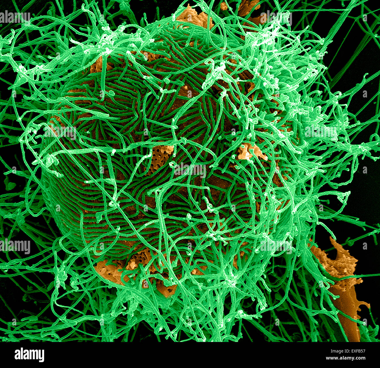 Filamentous Ebola virus particles (colored green) budding from a chronically-infected VERO E6 cell (colored yellow) Stock Photo