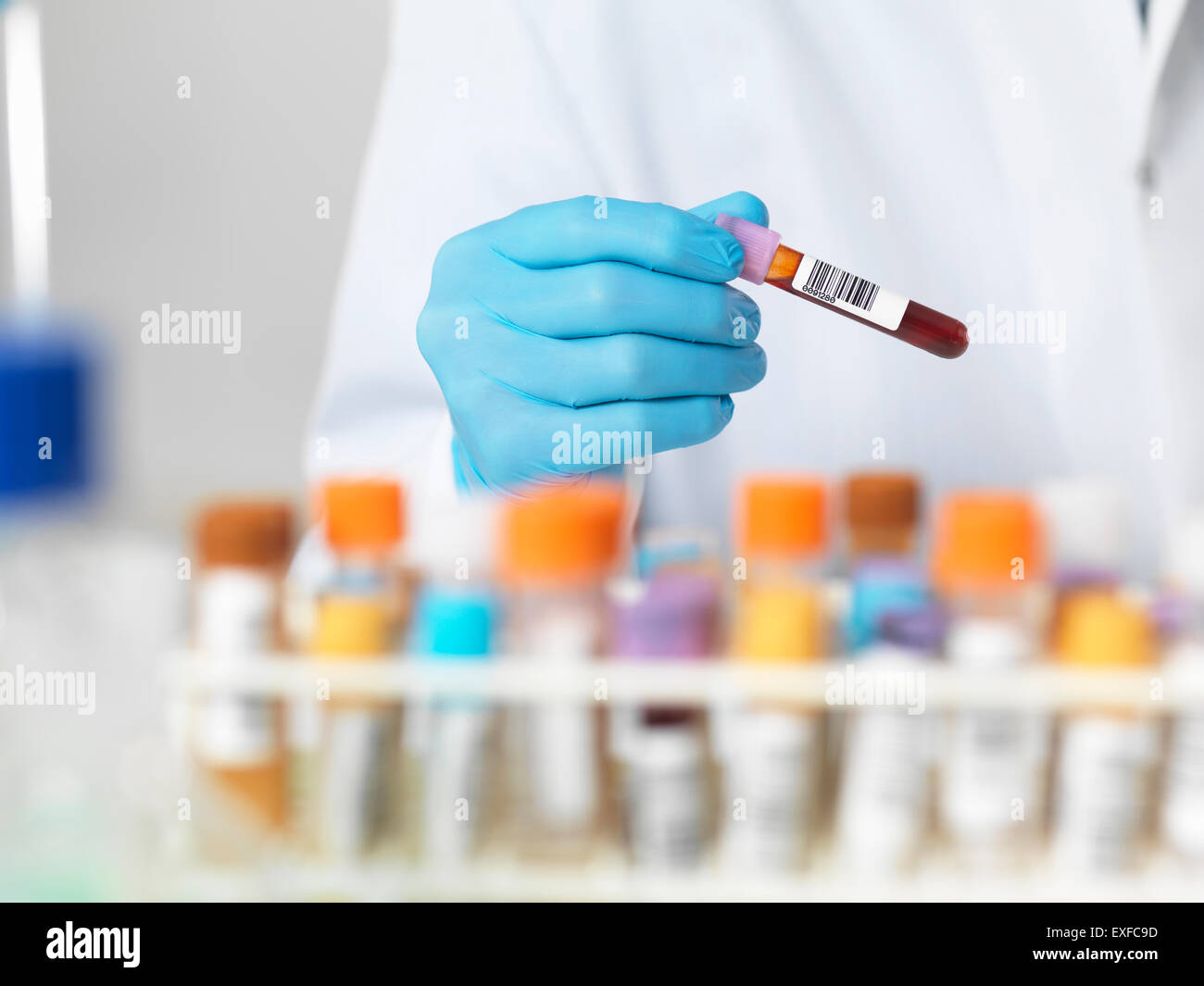 Close up of scientists hands selecting a blood sample for medical testing Stock Photo