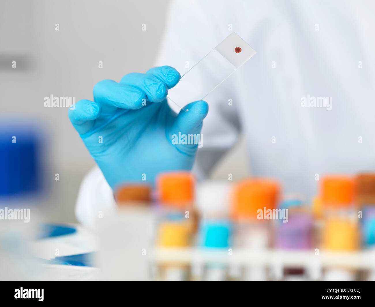 Close up of scientists hand holding blood sample on a glass microscope