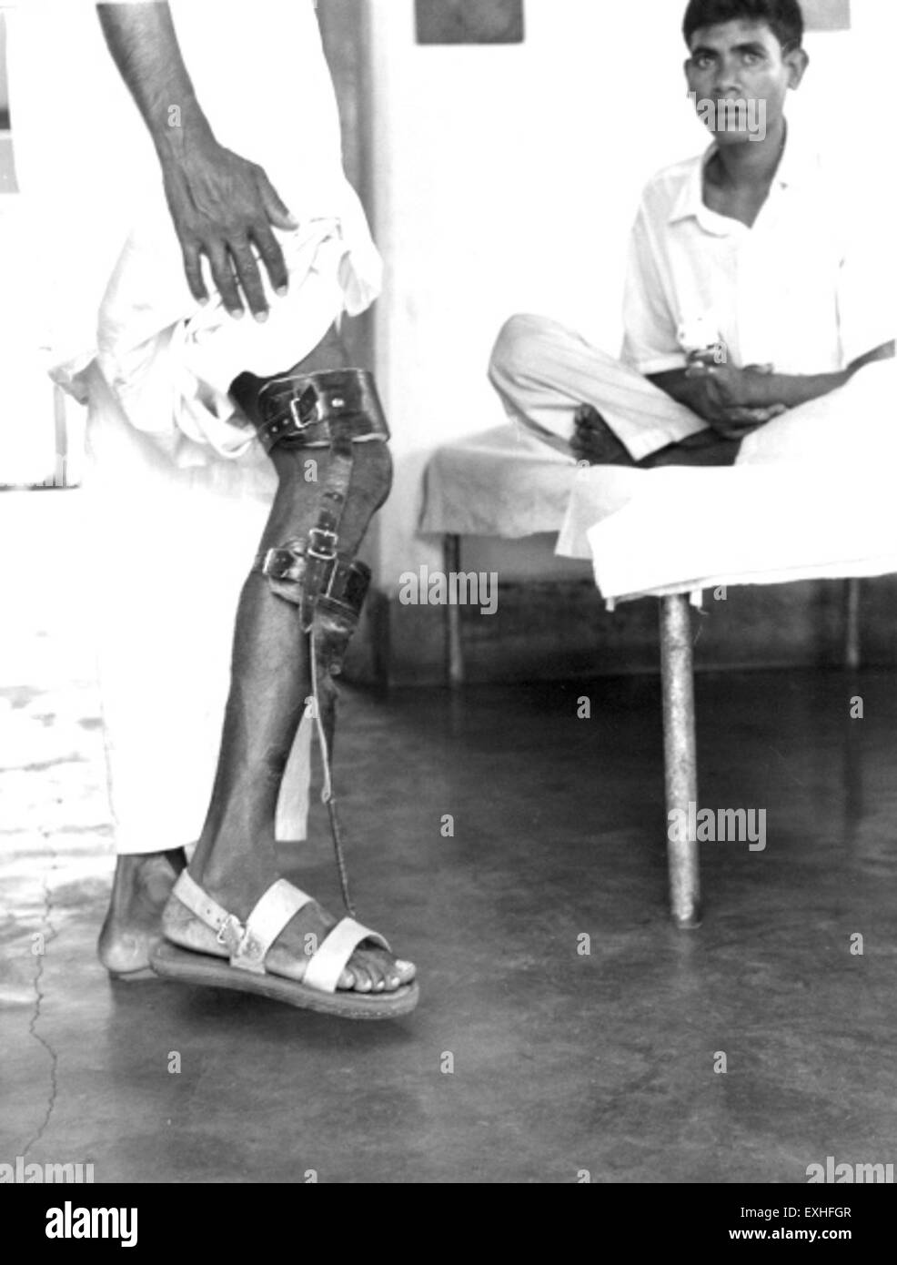 Leper patient, Shantipur, India, undated 1 Stock Photo