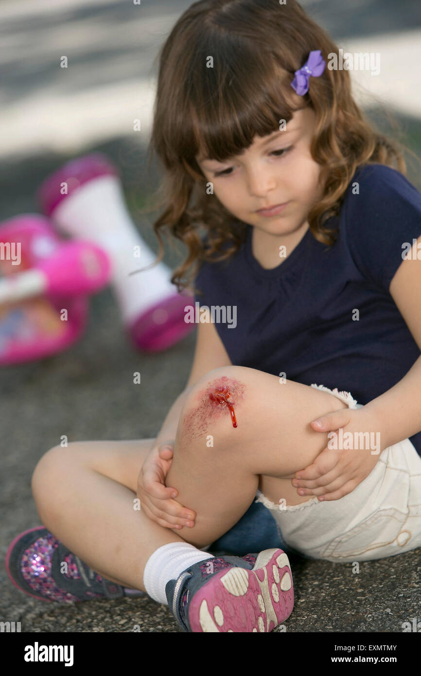 Child hurt knee outdoors hires stock photography and images Alamy