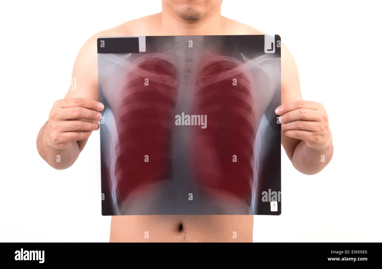 Male chest anatomy hi-res stock photography and images - Alamy