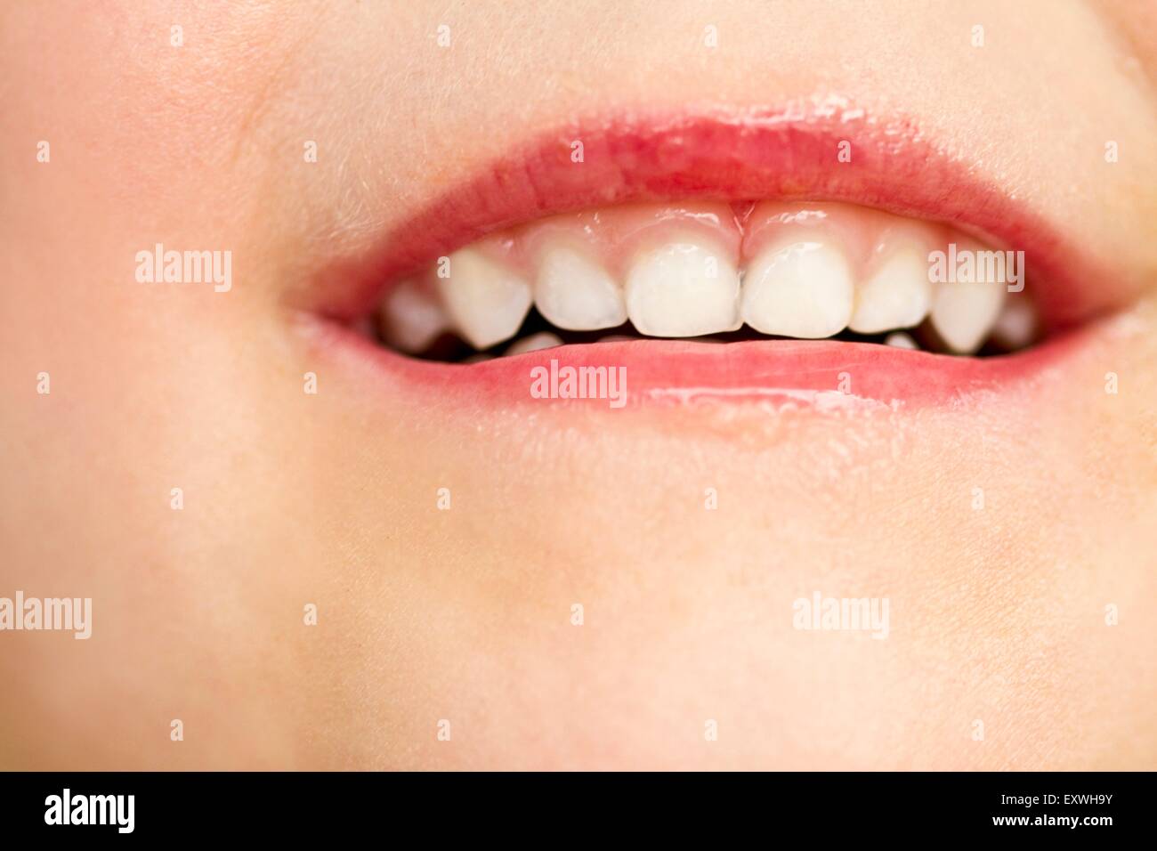 Milk teeth of a girl Stock Photo