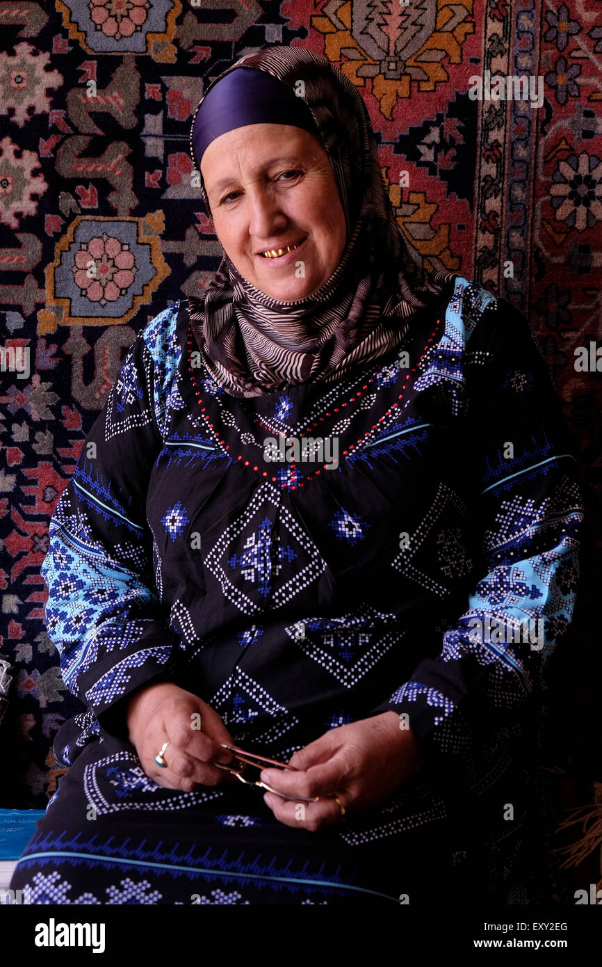 A woman with gold capped teeth in Lahij or Lahic village within the Ismailli Rayon of Azerbaijan. Replacing natural teeth with gold implants or caps was once a status symbol and prestige in Central Asia. Stock Photo