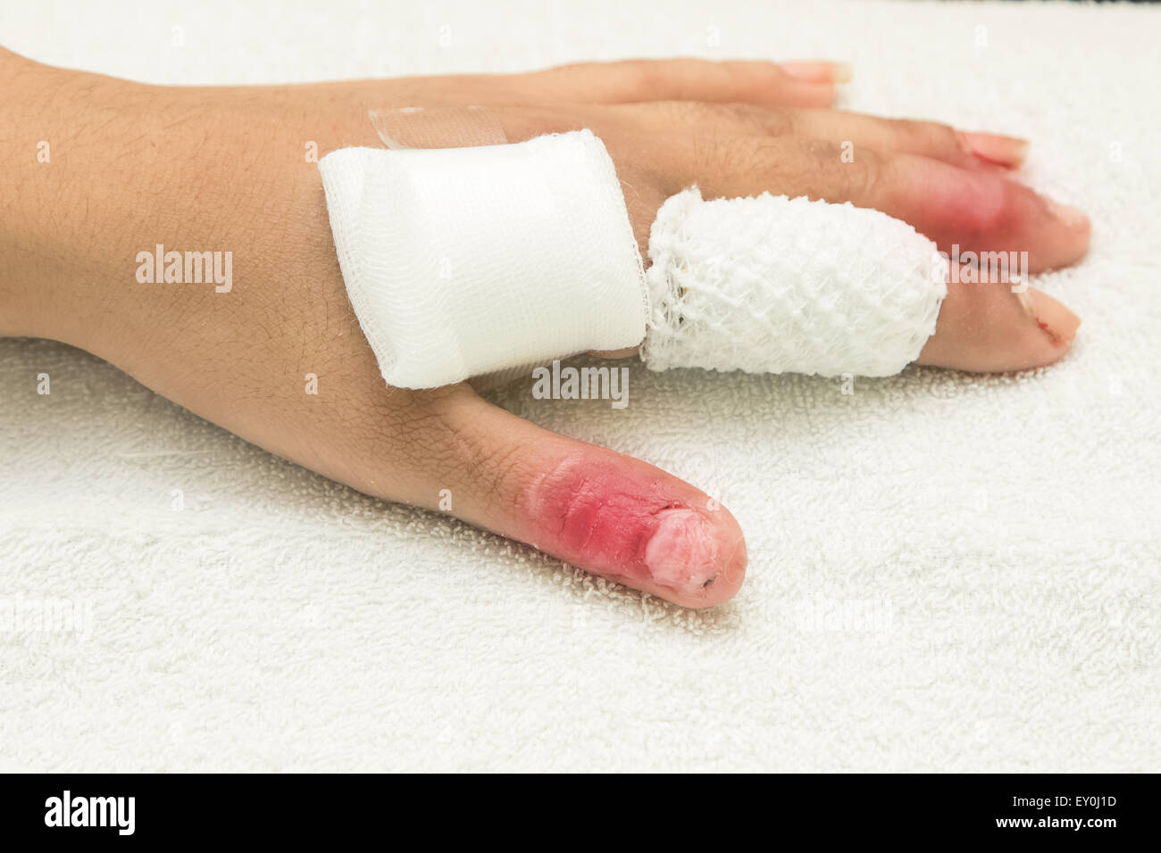 finger wrap gauze