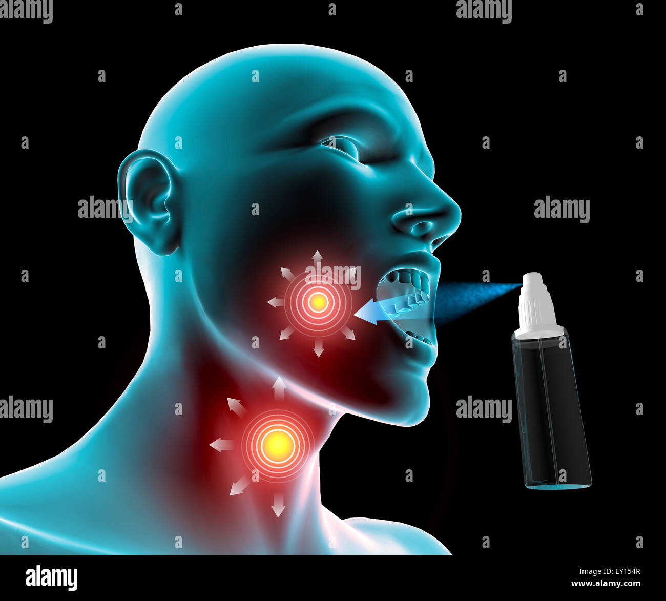 Sore throat inflammation, pain, spray atomizer Stock Photo Alamy