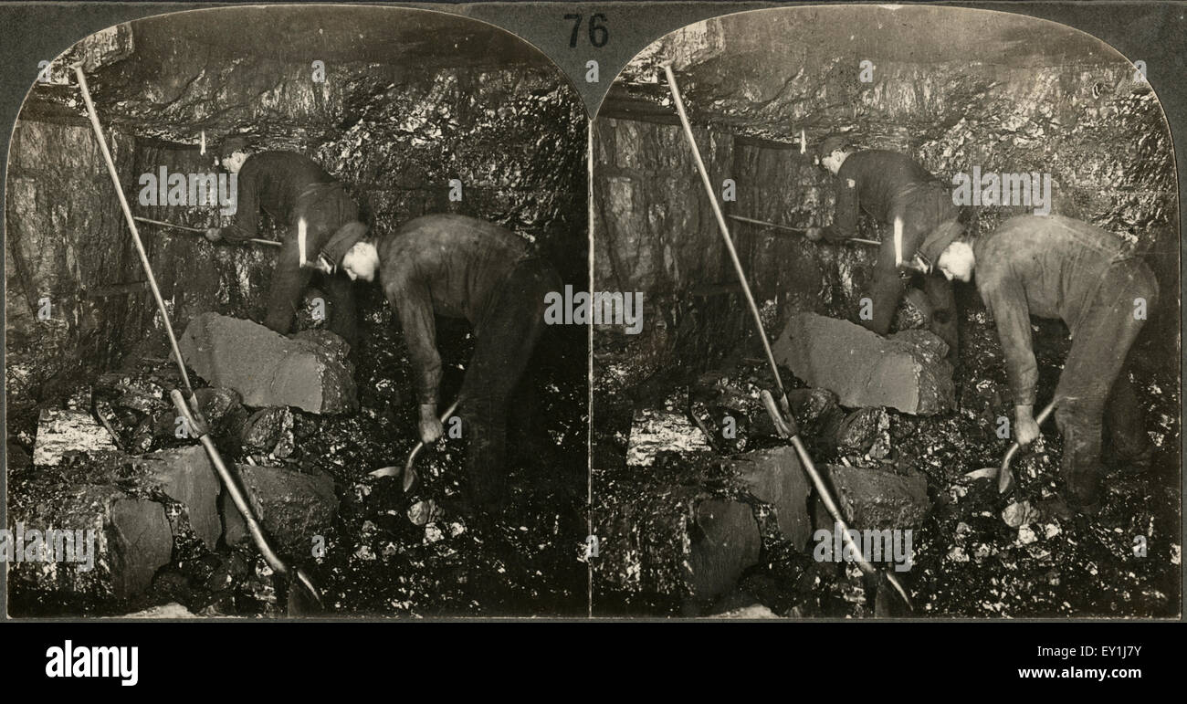 Miner Drilling and Laborer Loading Anthracite, Scranton, Pa,  Single Image of Stereo Card, circa 1915 Stock Photo