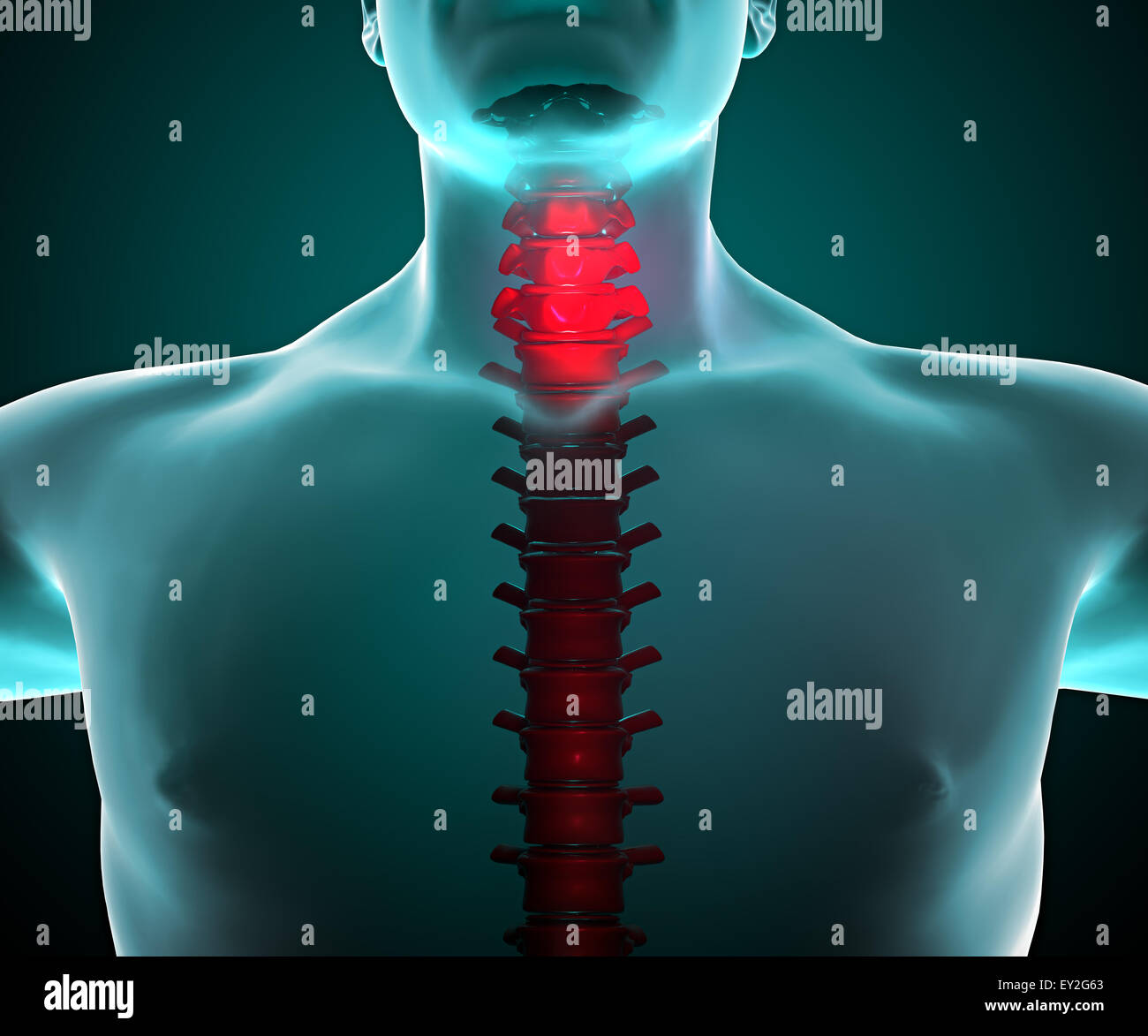 Human body seen from the front with a x-ray view of the neck and spine Stock Photo