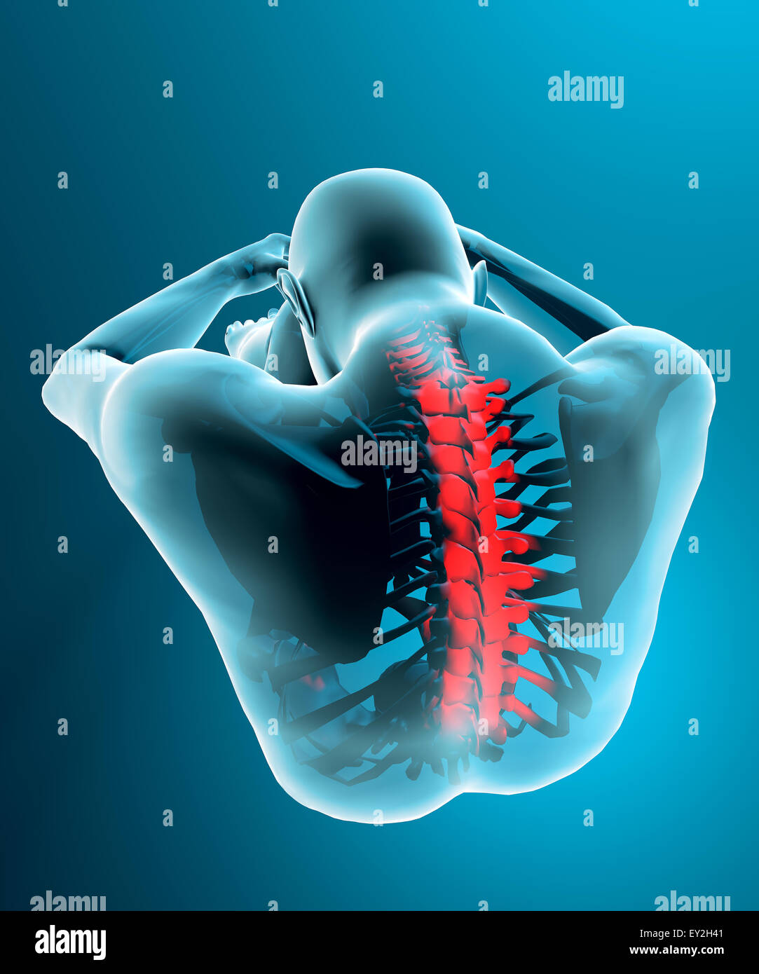 Human body seen from behind with a x-ray view of the spine Stock Photo