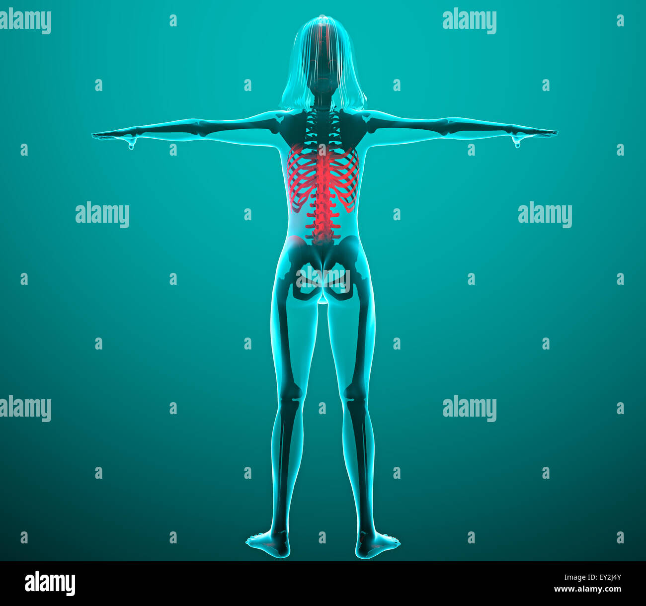3d Human x-ray with pain in the spine and ribs Stock Photo