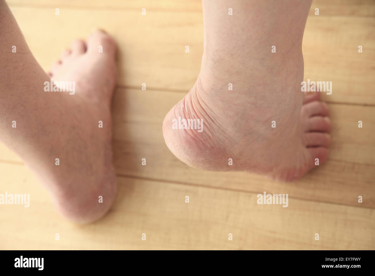 An older man rises on tip toes to show his heel. Stock Photo