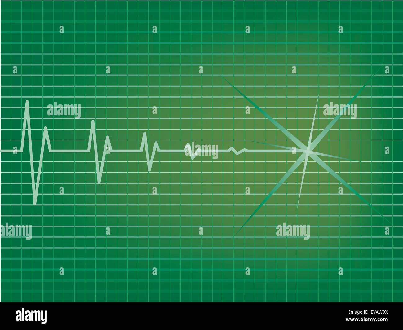 Heart is slowing down on EKG monitor Stock Vector