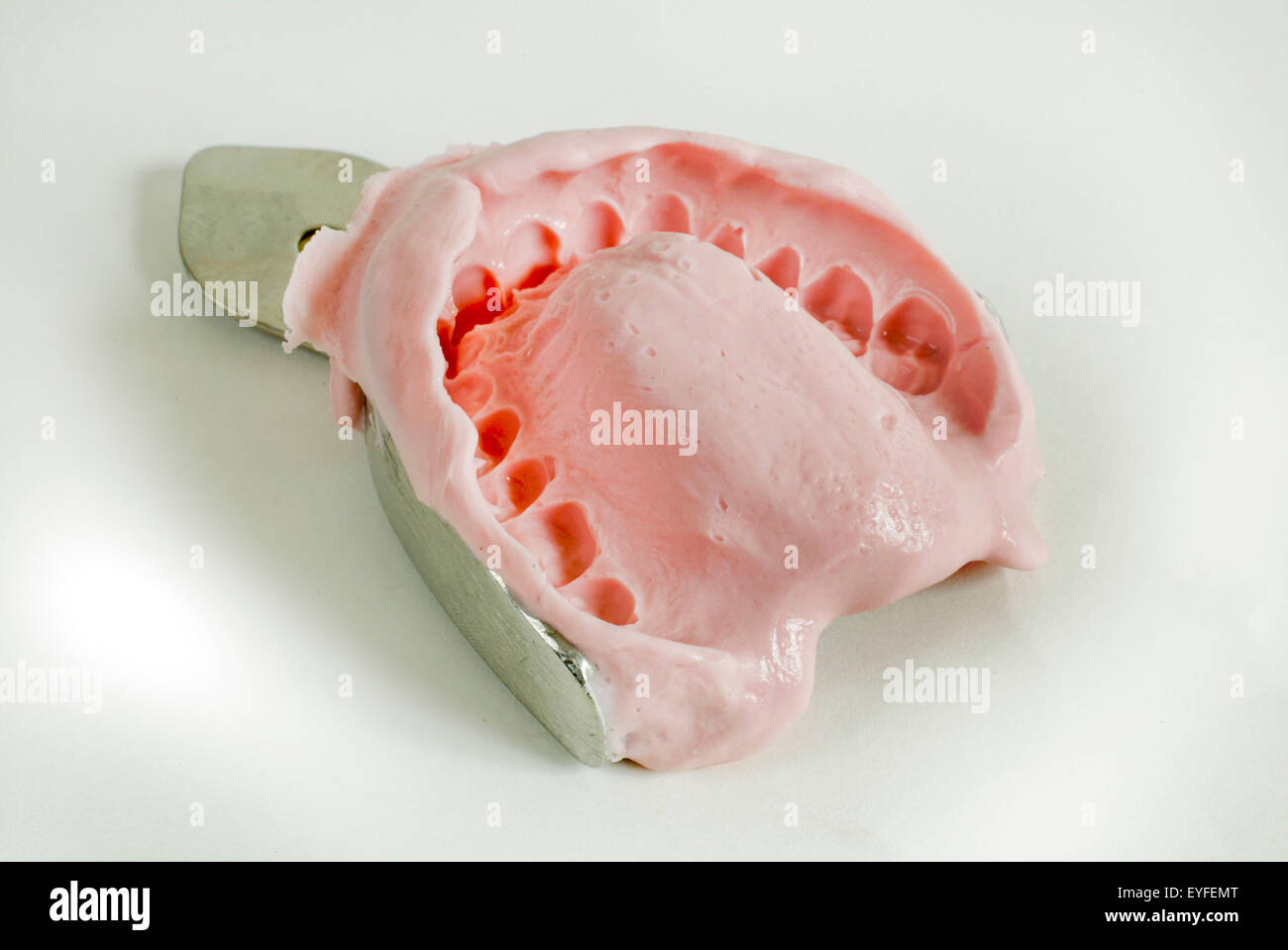 A full upper jaw Alginate negative impression to obtain diagnostic study models of the teeth and surrounding structures. Stock Photo