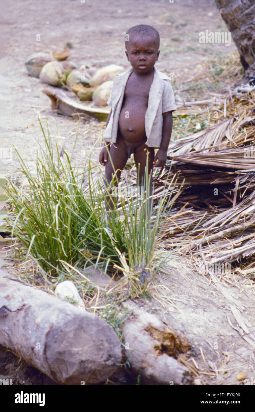 Poor Haitian boy, wearing only a shirt. His belly shows signs of malnutrition. Photo taken days after Hurricane Allen in 1980. Stock Photo