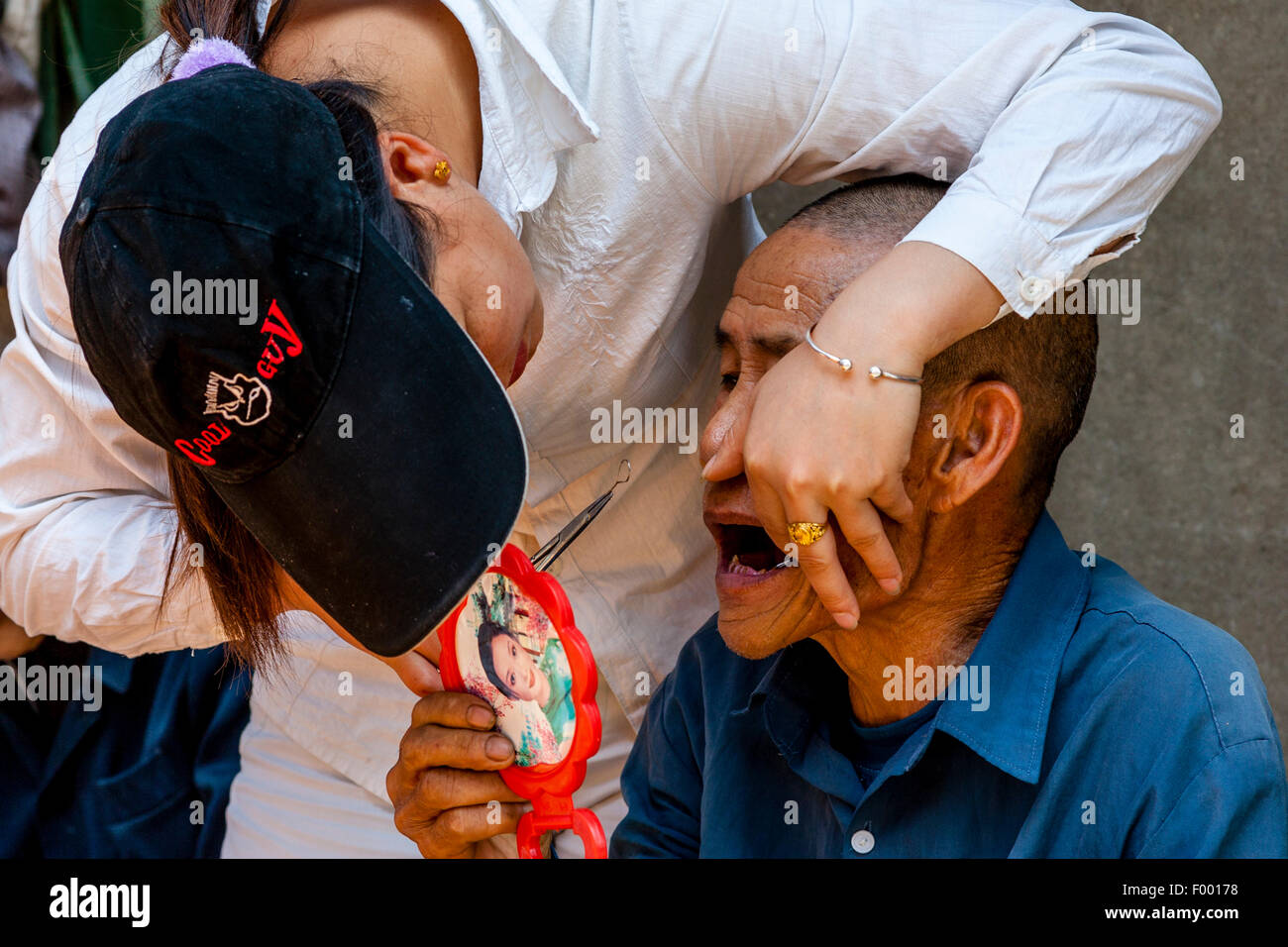 A Street Dentist Examines The Teeth Of An Elderly Man, Xingping Town near Guilin, Guangxi Province, China Stock Photo