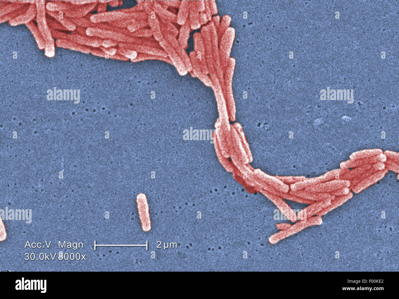 Colorized scanning electron micrograph (SEM) depicted a scattered grouping of Gram-negative Legionella pneumophila  bacteria. Mag 8000X Stock Photo