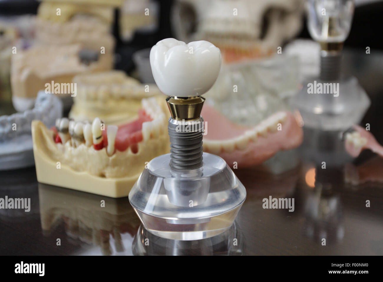 Giant tooth on crystal stand with dentures and dental samples in background Stock Photo