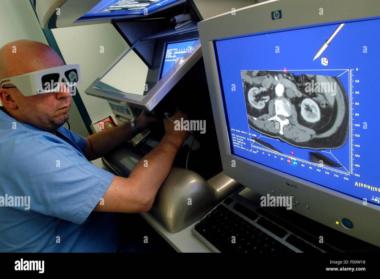 Orthopedic Institute Galeazzi (Milan, Italy), console for the analysis of the images of diagnostic radiology in 3D "Dextroscope" Stock Photo