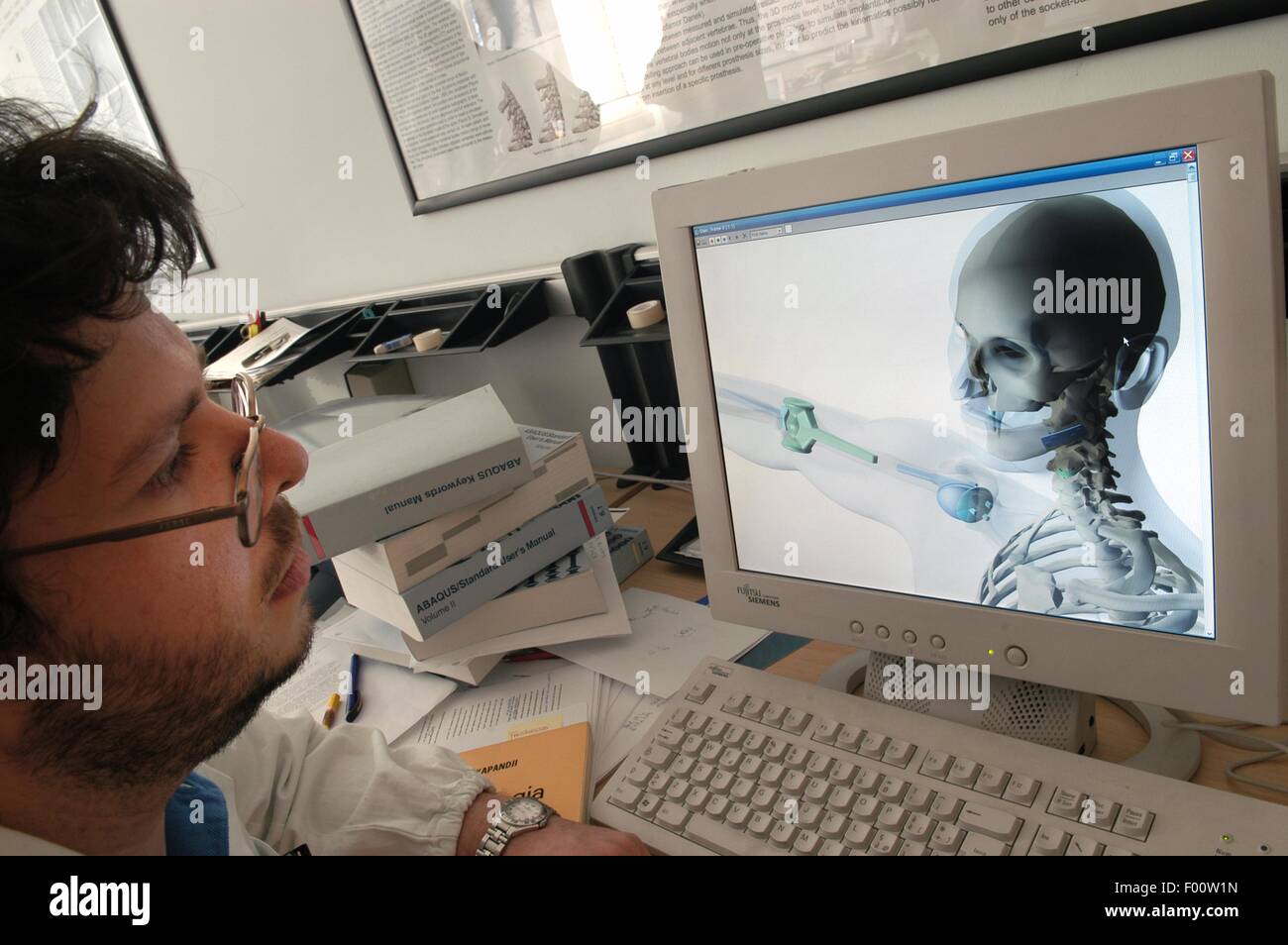 Orthopedic Institute Galeazzi (Milan, Italy), 3D images of prosthesis on computer monitor Stock Photo