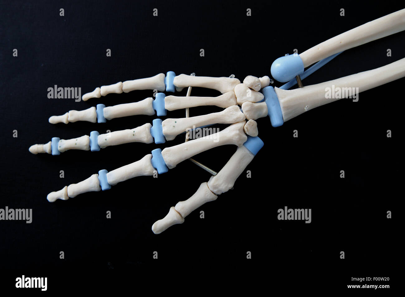 Orthopedic Institute Galeazzi (Milan, Italy), prosthesis of hand ligament Stock Photo