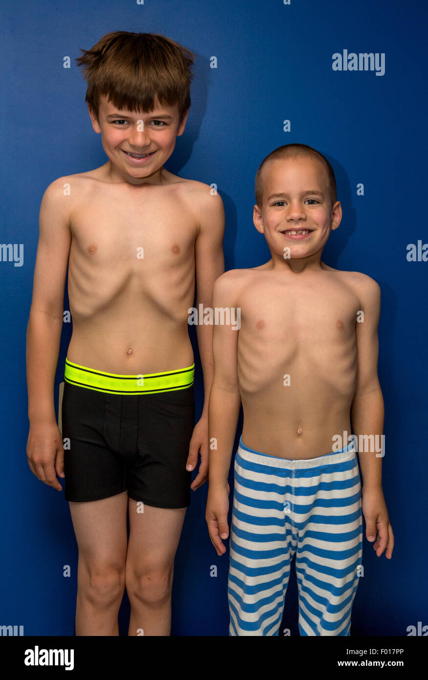 Young Boys (Ages 9 and 7) Showing off their Rib Cages for Fun.  MR Stock Photo