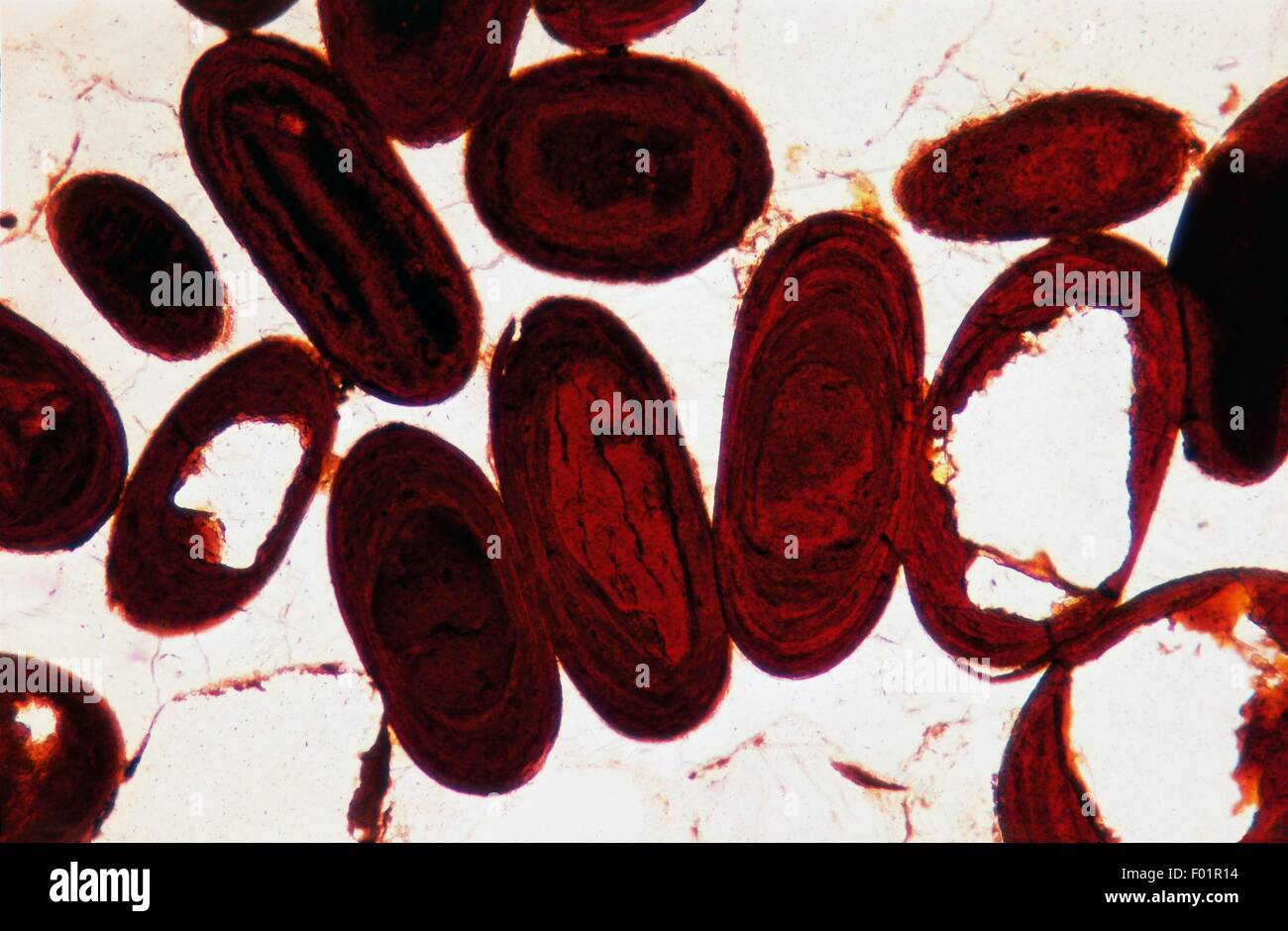 Limonitic oolite, thin section using parallel nicols, x100. Stock Photo