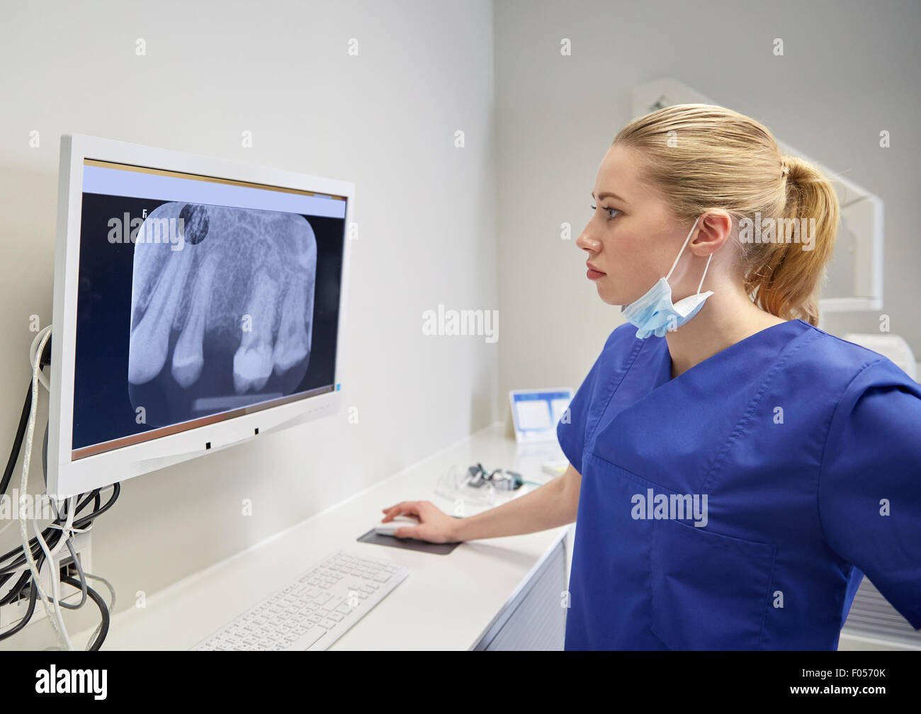 dentist with xray on monitor at dental clinic Stock Photo Alamy