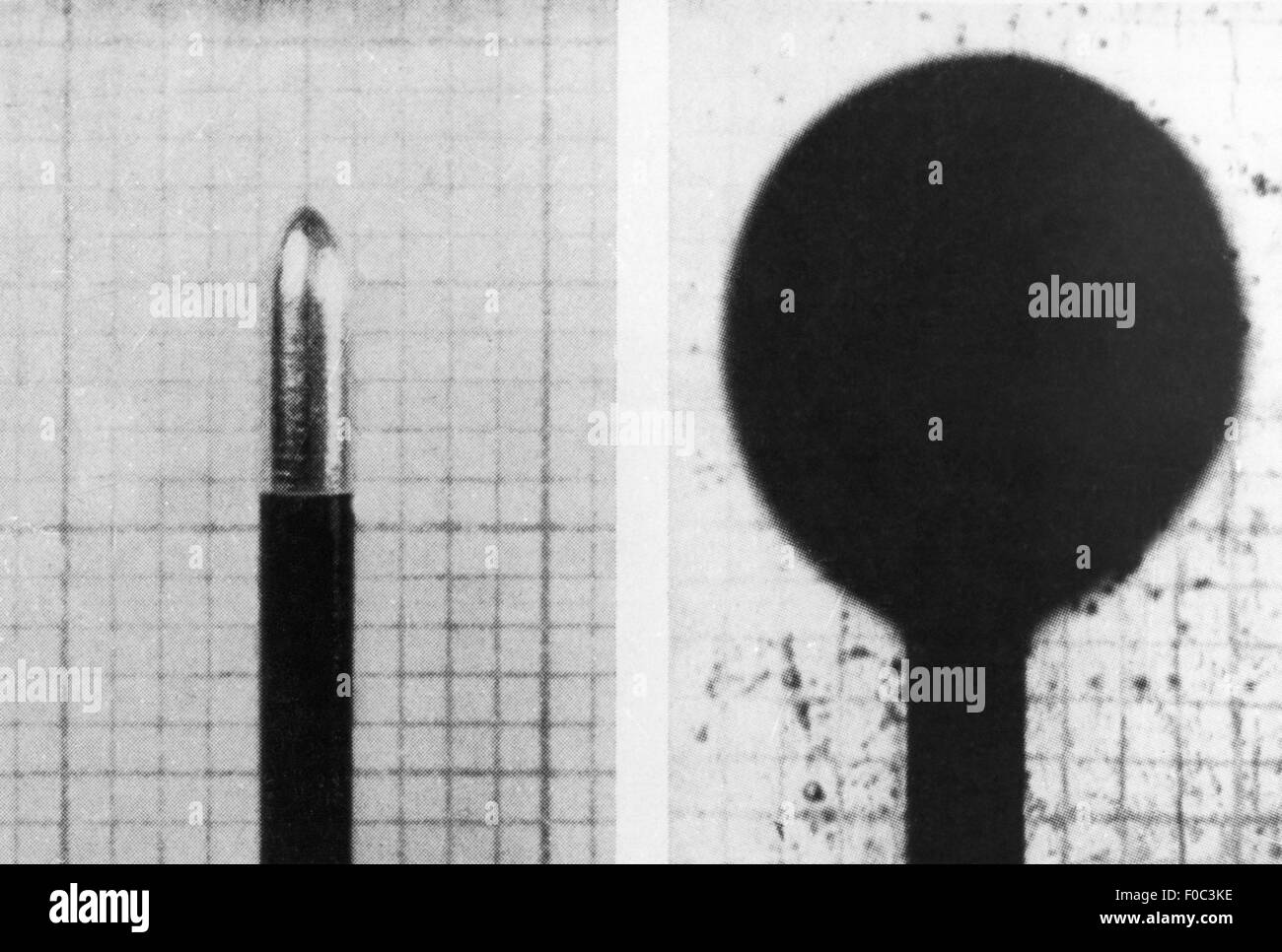 medicine, operation, brain and neurosurgery, unipolar coagulation electrode and generated lesion, 20th century, 20th century, undergo surgery, need surgery, brain surgery, neurosurgery, electrosurgery, high-frequency surgery, diathermy, electrocauterisation, lesion, medicine, medicines, operation, operations, coagulation electrode, coagulation electrodes, historic, historical, Additional-Rights-Clearences-Not Available Stock Photo