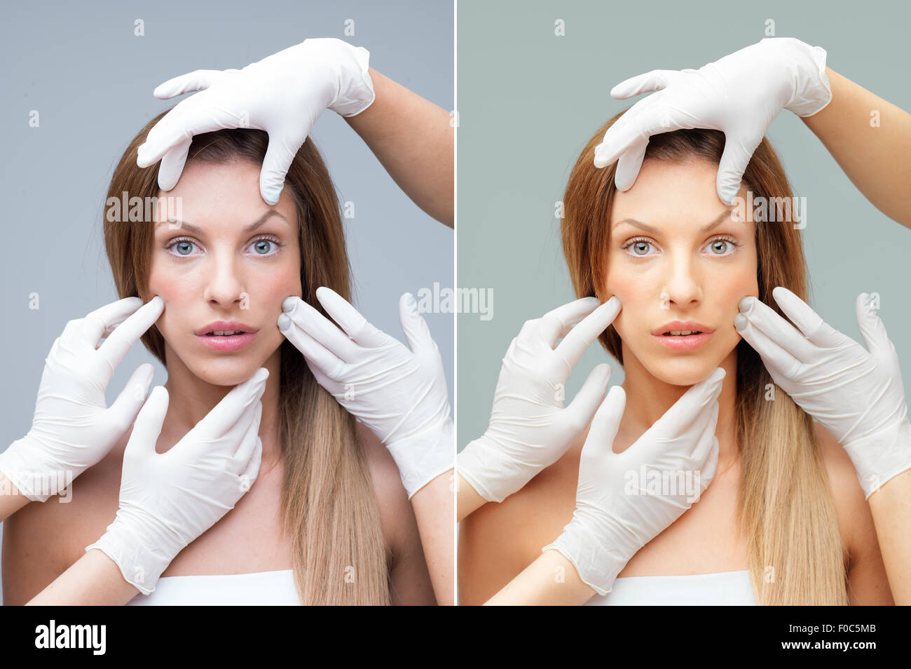 young woman being examinated plastic surgeons' hands before and after retouching Stock Photo