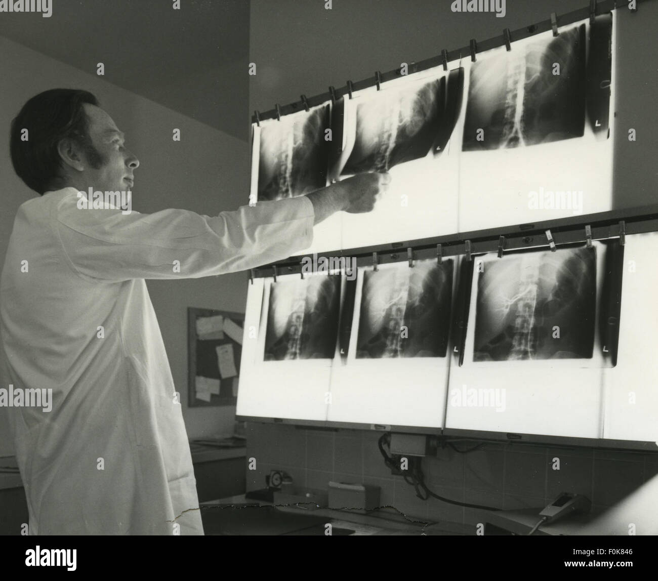 History of x rays hires stock photography and images Alamy