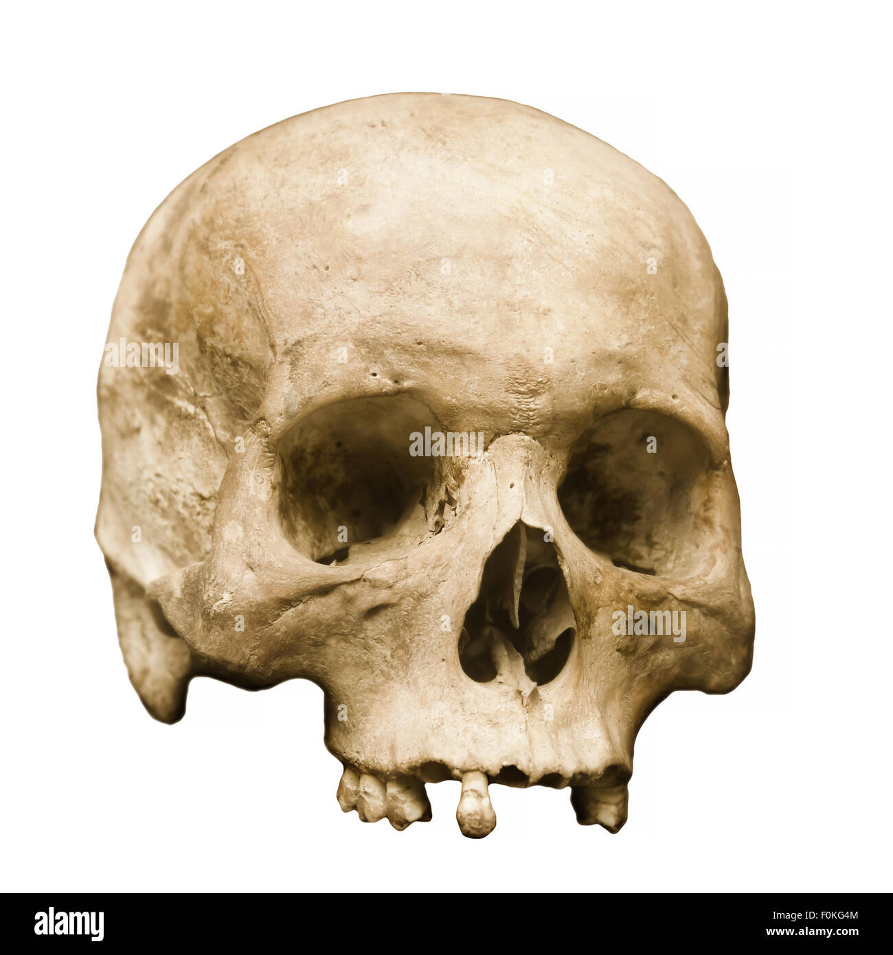 Highly detailed image of a human skull, minus the jaw, displayed against a white background.  Some teeth remain, and pores in th Stock Photo