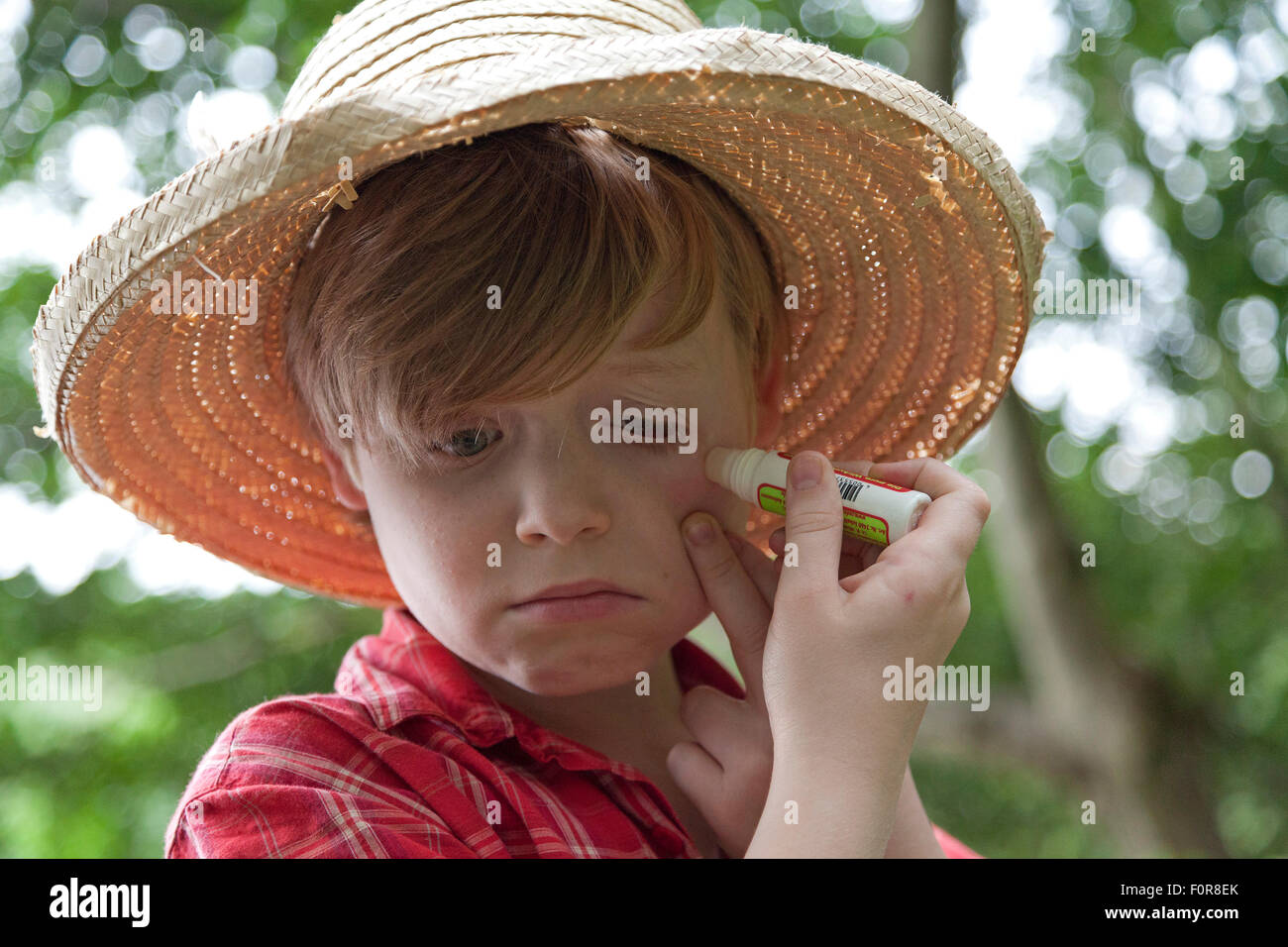 sad young boy applying medication to his insect sting Stock Photo