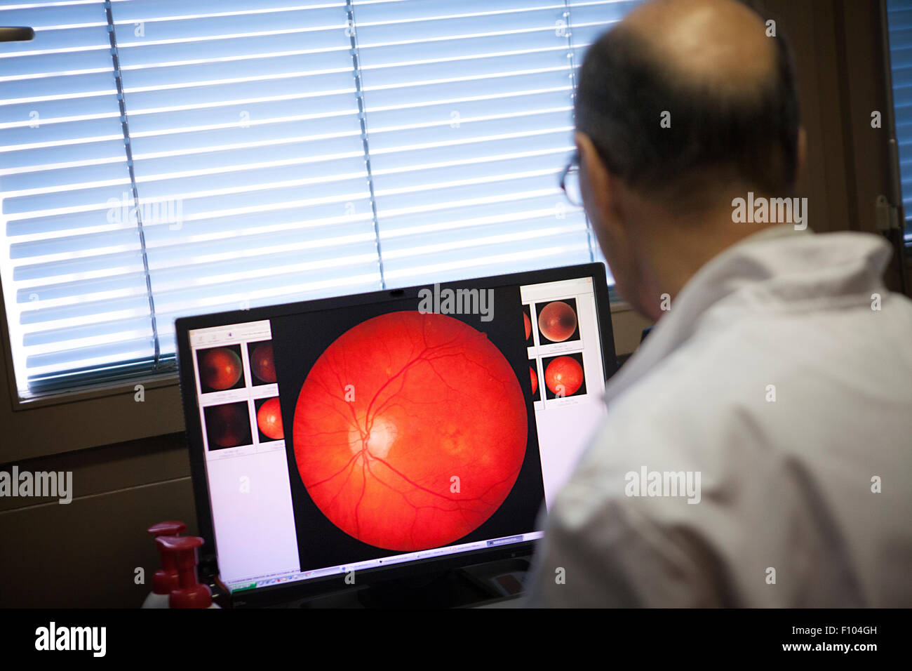 OPHTALMOLOGY CONSULTATION Stock Photo