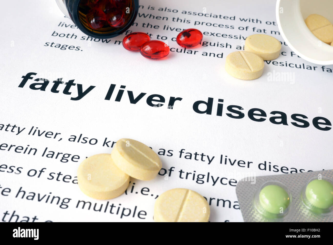 Paper with fatty liver disease  and pills. Medical concept. Stock Photo